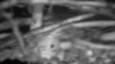 Dinkelsbühl Huidige Webcam Image Dinkelsbühl Huidige Webcam Image